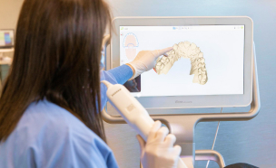 口腔内スキャナー「iTero」を使用